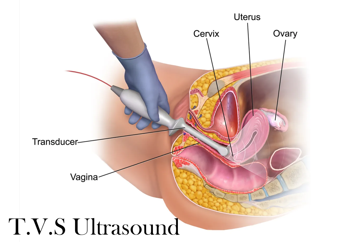 TVS Ultrasound